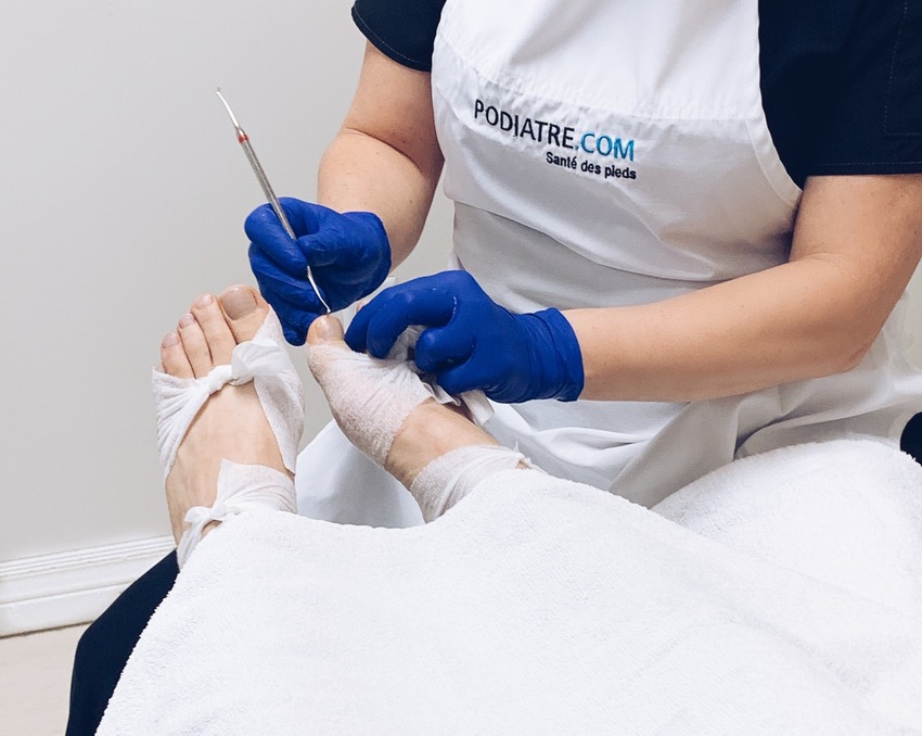 Soins de pied